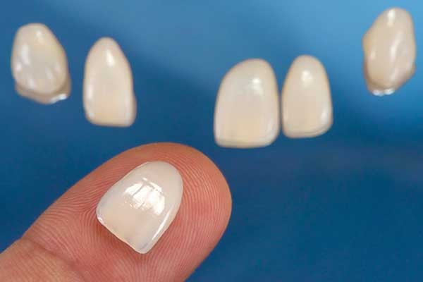 Porcelain Veneers in NYC