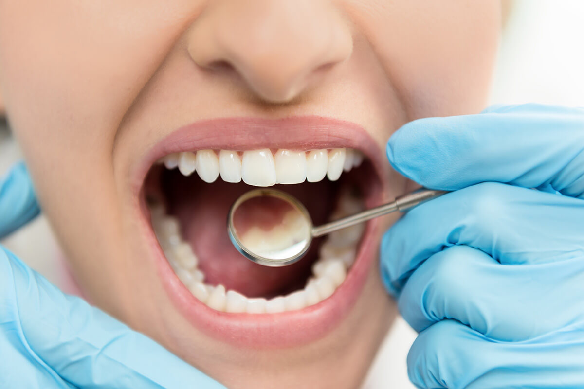 How Often Should You Get Your Teeth Cleaned?