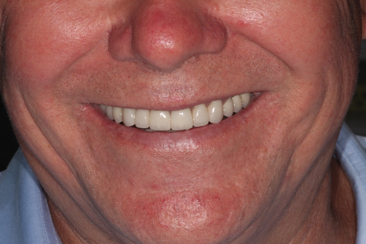 close up of man's mouth