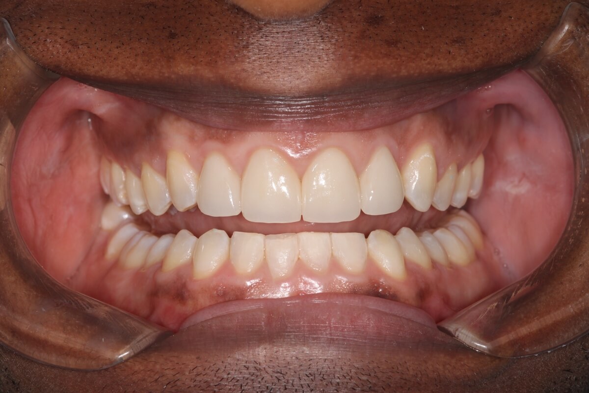 close up of man's mouth