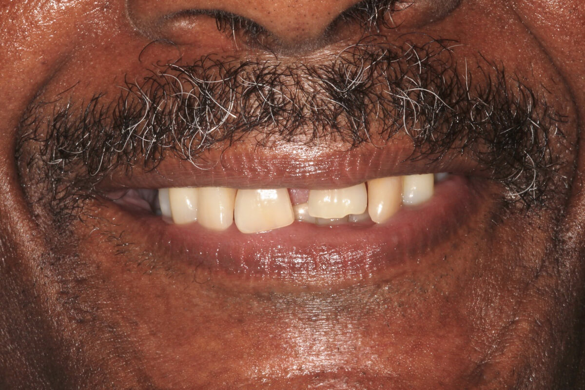 close up of man's mouth