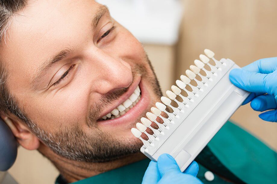 What Are Dental Veneers