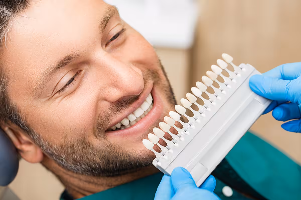 What Are Dental Veneers blog