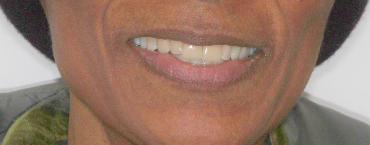 close up of female patient's mouth