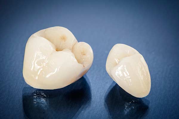 Dental Crowns in NYC