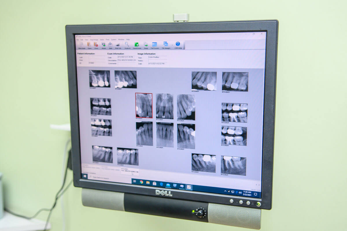 computer screens which show dental x-rays