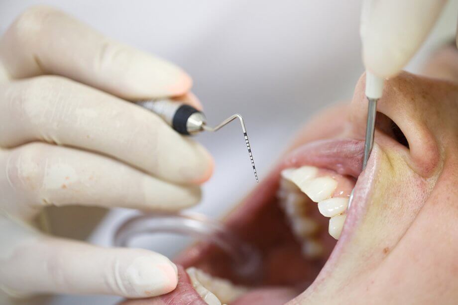 How Periodontal Therapy Can Save Your Natural Teeth