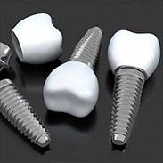 Dental Implants on the Upper West Side