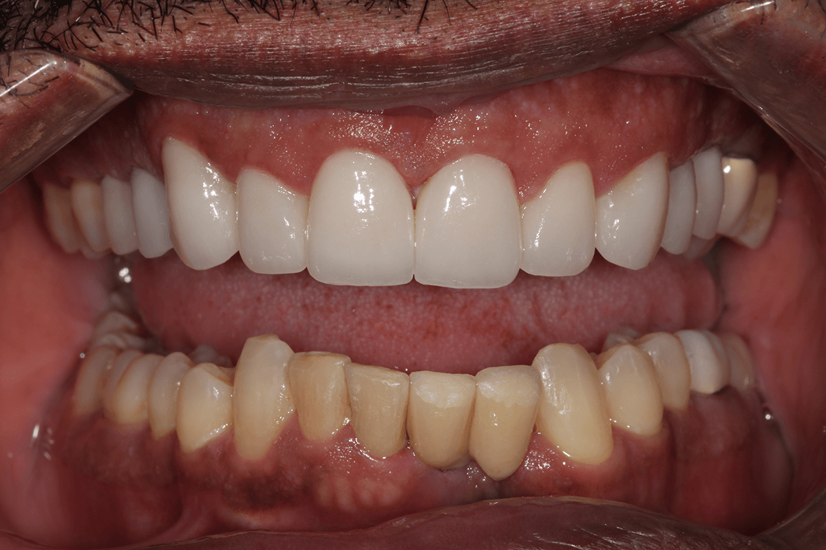close up of teeth