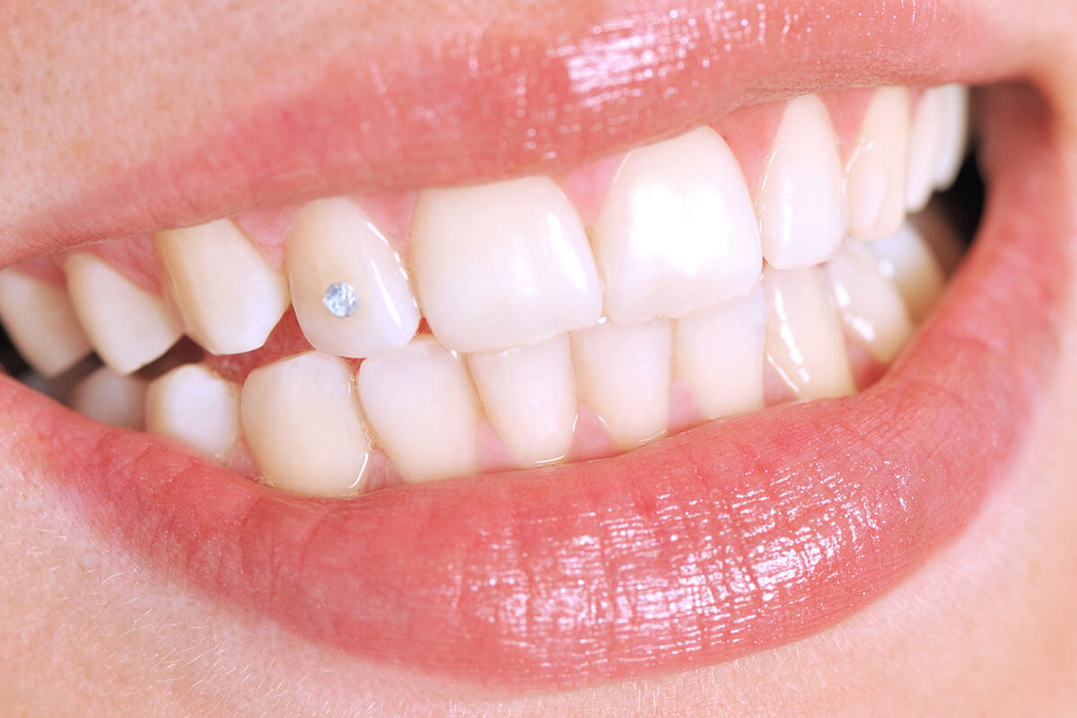 Tooth with Jewel