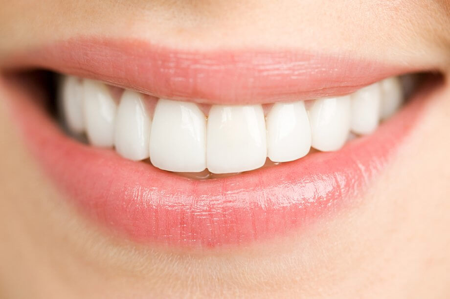 What Is The Best Way To Whiten Your Teeth?