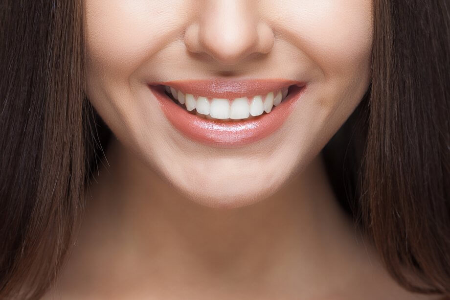 What Should I Eat After Teeth Whitening?